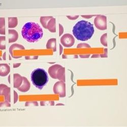 Blood cell count differential lab solved report cbc signal answers transcribed problem text been show has