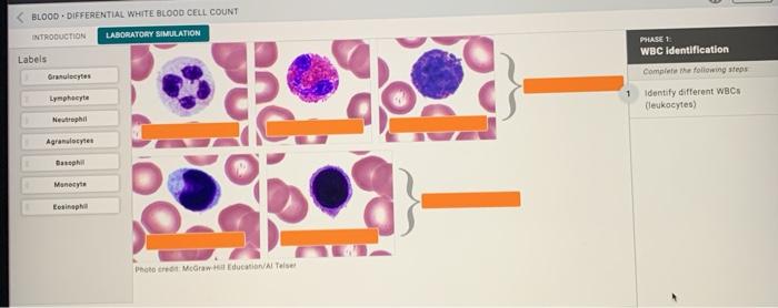 Blood cell count differential lab solved report cbc signal answers transcribed problem text been show has